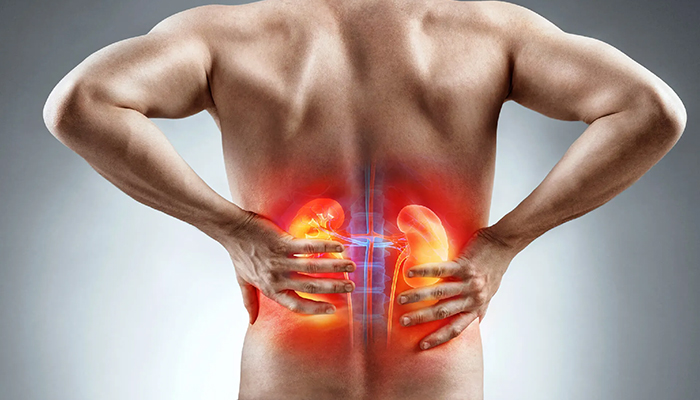 Acute Kidney Injury