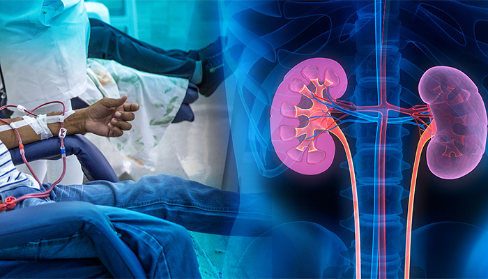 What is Dialysis?